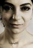 Özlem Turhal