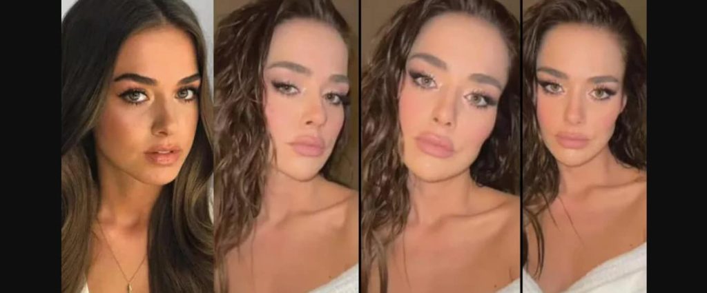 Bensu Soral'a estetik şoku!