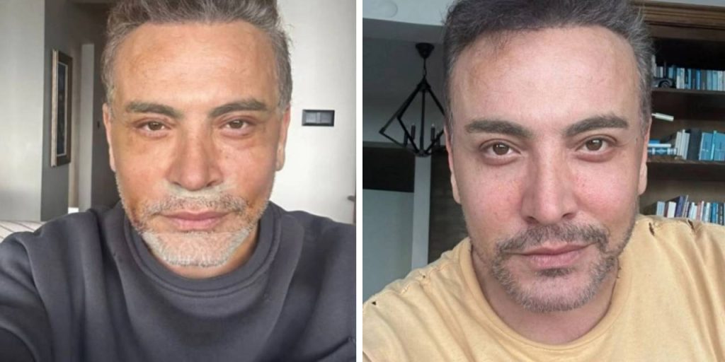 Cenk Eren'den üzen haber!