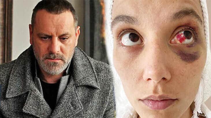 Deniz Bulutsuz'u darp eden Ozan Güven Babil dizisinden atıldı!