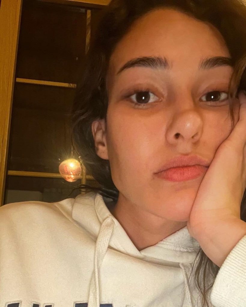Dilan Çiçek Deniz estetik iddialarına cevap verdi