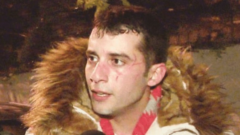 İzzet Altunmeşe’nin oyuncu oğlu Fırat Altunmeşe sevgilisinden şiddet gördü! İzzet Altunmeşe'nin oyuncu oğlu Fırat Altunmeşe sevgilisinden şiddet gördü!