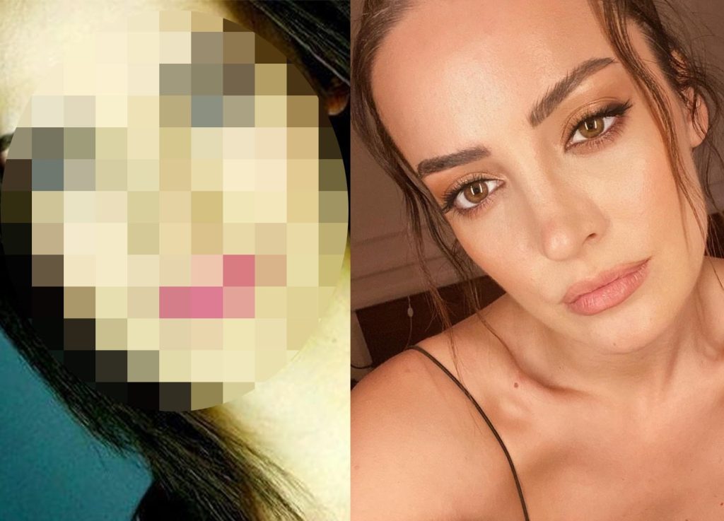 ÖZEL HABER | İrem Sak'ın estetiksiz haliyle şok olmaya hazırlanın!