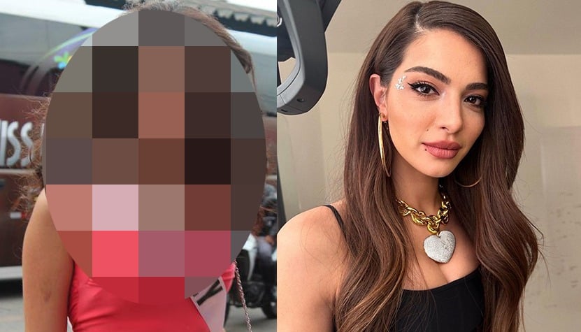ÖZEL HABER | Melisa Aslı Pamuk'un estetiksiz hali ortaya çıktı!