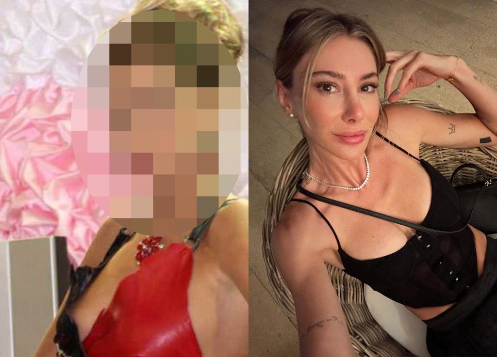ÖZEL HABER | Şeyma Subaşı'nın estetiksiz halini görenler "Yok böyle değişim!" diyecek...