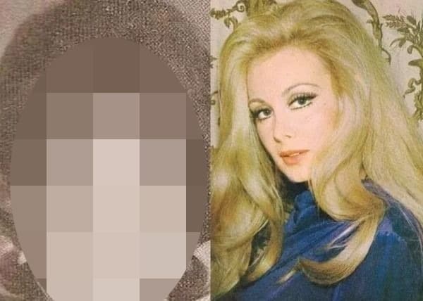 ÖZEL HABER | Usta oyuncu Filiz Akın meğerse estetikle baştan yaratılmış!