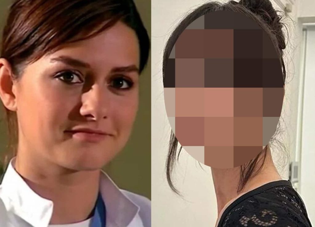 ÖZEL HABER | Yasemin Özilhan da 'estetikli' camiasına katıldı!