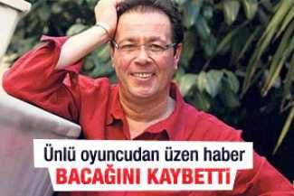 Ünlü oyuncunun bacağı kesildi!