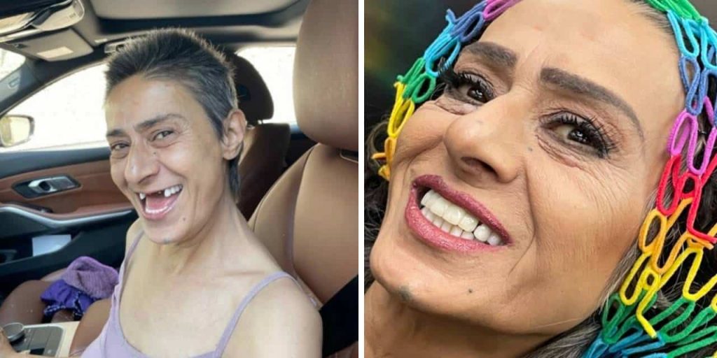 Yıldız Tilbe'den 'dişli' paylaşım!